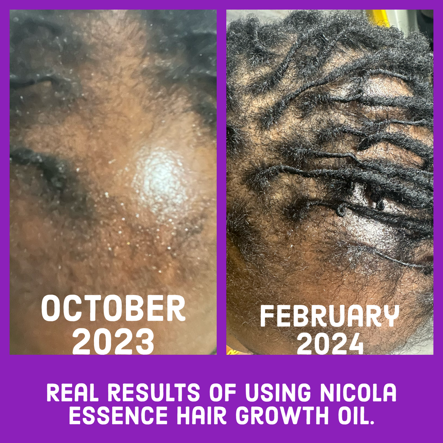 Hair Growth Oil - Original Available in 1 and 4 oz